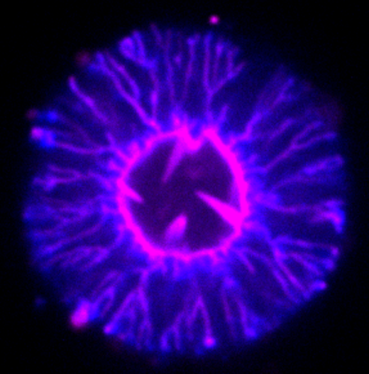 Figure 2: Membrane deformations induced by actin assembly. A membrane bilayer (pink) constituting an initially spherical liposome is deformed through the growth of a branched actin network (blue marks the colour of the end of actin filaments) at its surface. Spikes (inward) and tubes (outward) are formed during this process. Note that compared to the cell geometry, the geometry here is inside out, as the ingredients of the cytoskeleton are outside the liposome. Bar 5 μm. Copyright: Cécile Sykes, CNRS