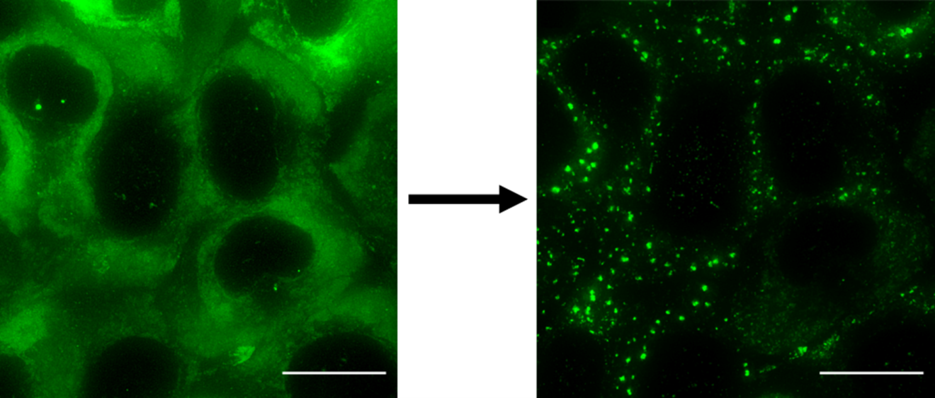 Figure 1: The formation of stress granules in human cells upon the addition of Sodium Arsenite. Green regions show the location of G3BP, a protein which is known to localise in stress granules. Scale bar: 20 μm. Copyright: Published in Law J. O. et. al., Sci. Adv., 9, eadg0432 (2023) under a Creative Commons Attribution 4.0 International License.