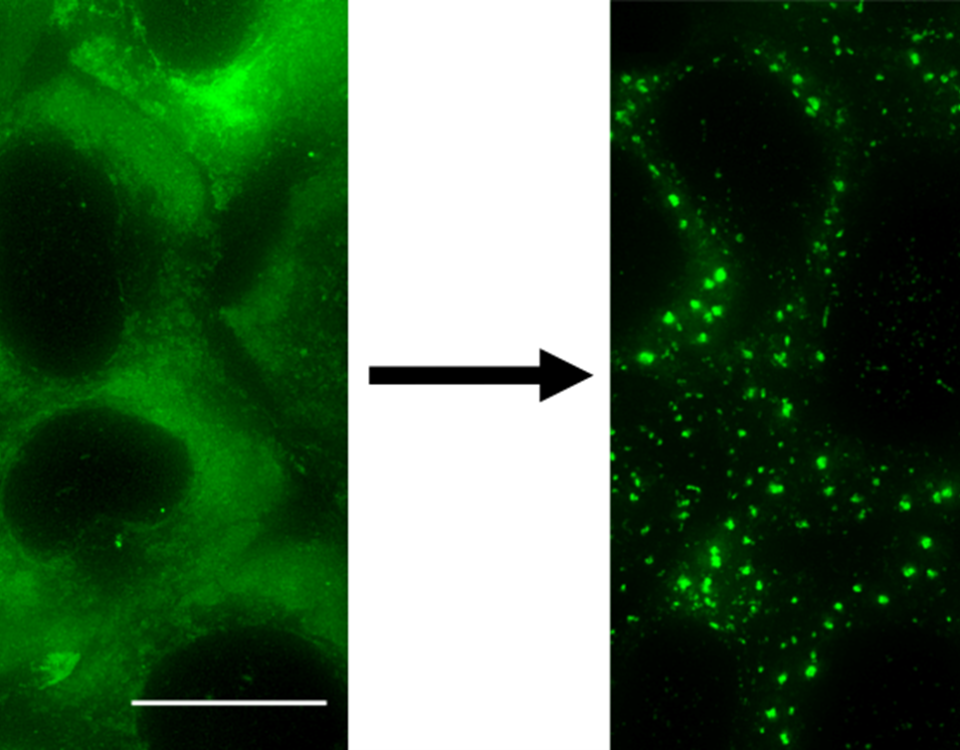 Figure 1: The formation of stress granules in human cells upon the addition of Sodium Arsenite. Green regions show the location of G3BP, a protein which is known to localise in stress granules. Scale bar: 20 μm. Copyright: Published in Law J. O. et. al., Sci. Adv., 9, eadg0432 (2023) under a Creative Commons Attribution 4.0 International License.