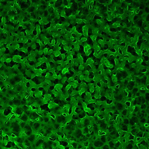 Fig. 2: Evaporating of a droplet of buffered tick-GRP77 solution (containing fluorescently labelled tick-GRP77 molecules for visualization) resulted in a phase separation that manifested itself in a stunning pattern. Copyright: authors