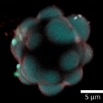 3D reconstruction of a flower-shaped liposome showing phase separated “petals” harboring coacervate “buds”. Copyright: The Authors. Published in Chen C. et. al, ACS Nano (2025) by the American Chemical Society. This publication is licensed under CC-BY 4.0 .